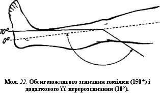 Обсяг можливого згинання гомілки (150°) і додаткового її перерозгинання (10°)
