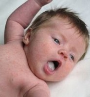 Білий язик у новонародженого