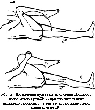 Визначення нульового положення кінцівки у кульшовому суглобі