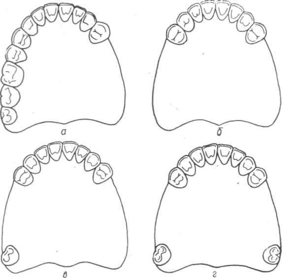 Класифікація дефектів зубних рядів за В. І. Кулаженко