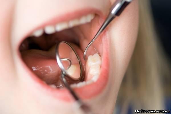Порушення розвитку і прорізування постійних зубів