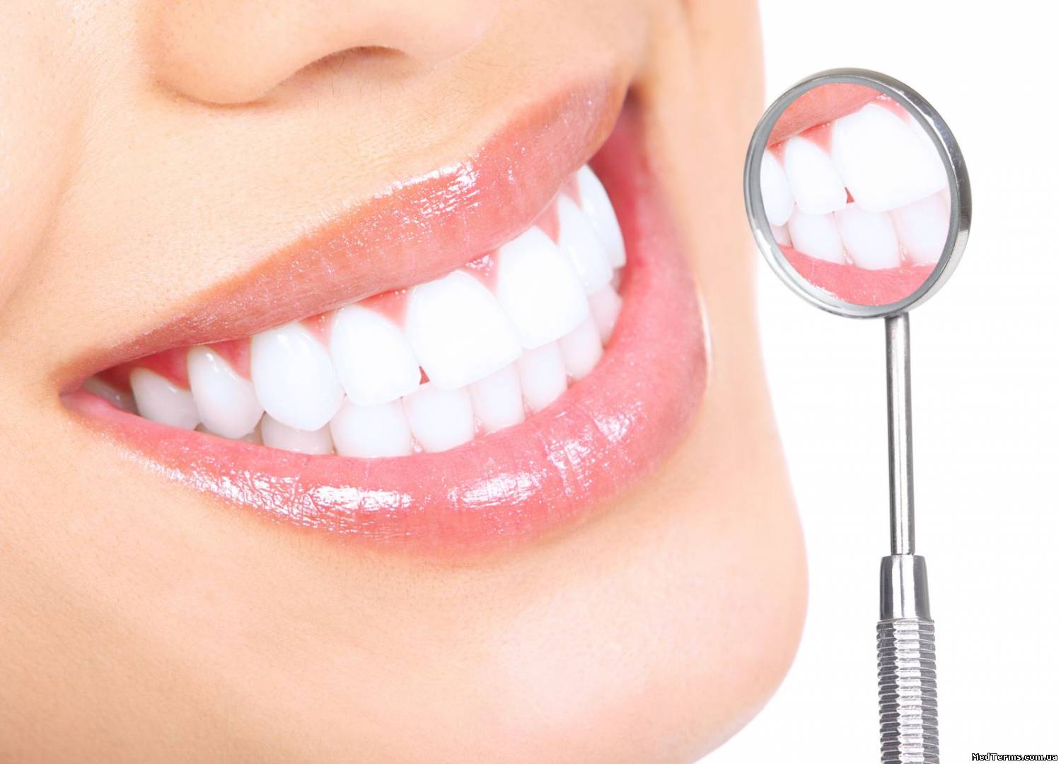 Профілактика карієсу зубів