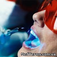 Професійне чищення зубів в деталях