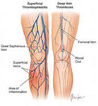 Анатомія вен нижніх кінцівок