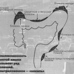 Мікрофлора шлунково-кишкового тракту і синдром роздратованого кишечника