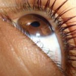 Очні краплі при глаукомі