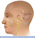 Лицевий нерв і його патологія. Судоми лицевого нерва