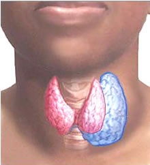 Рак щитовидної залози