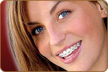 Іригатор - дбайливий догляд за зубами в післяопераційний період