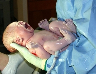 Профілактичний огляд новонародженого у лікаря
