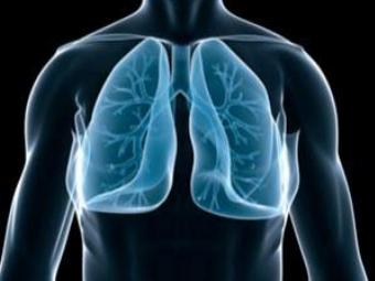 Азбестоз легенів