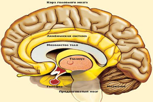 Астроцитома головного мозку