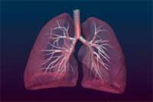 Плеврит легенів. Симптоми, діагностика і лікування