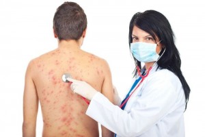 Шкірний висип при алергії