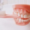 Як зміцнити ясна і зуби