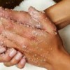 Суха шкіра рук лікування