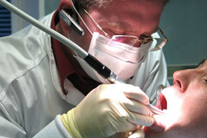 Лікування кісти кореня зуба
