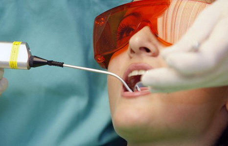 Лікування кісти зуба лазером