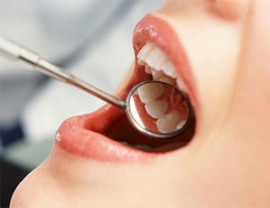 Лікування і профілактика стоматиту рота
