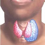 Токсична аденома щитовидної залози