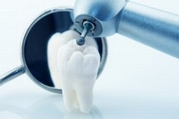 Протипоказання для імплантації зубів