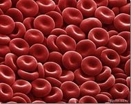 Серповидноклітинна анемія