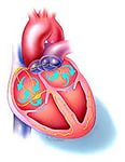 Синусова аритмія серця