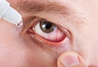 Хламідіоз очей: причини, симптоми, шляхи зараження