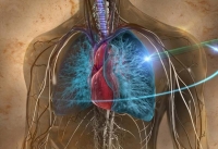 Лікування раку легенів