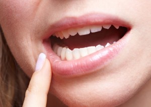 Чим лікувати стоматит у роті?