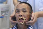 Китайцеві зроблять новий рот після нападу вовка