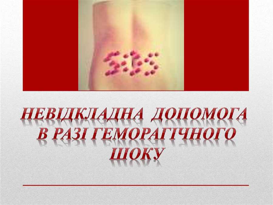 Гемотрансфузійний шок:Причини, Симптоми та Лікування